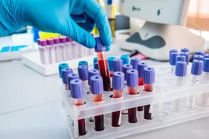 Gloved hand handling blood samples in a laboratory